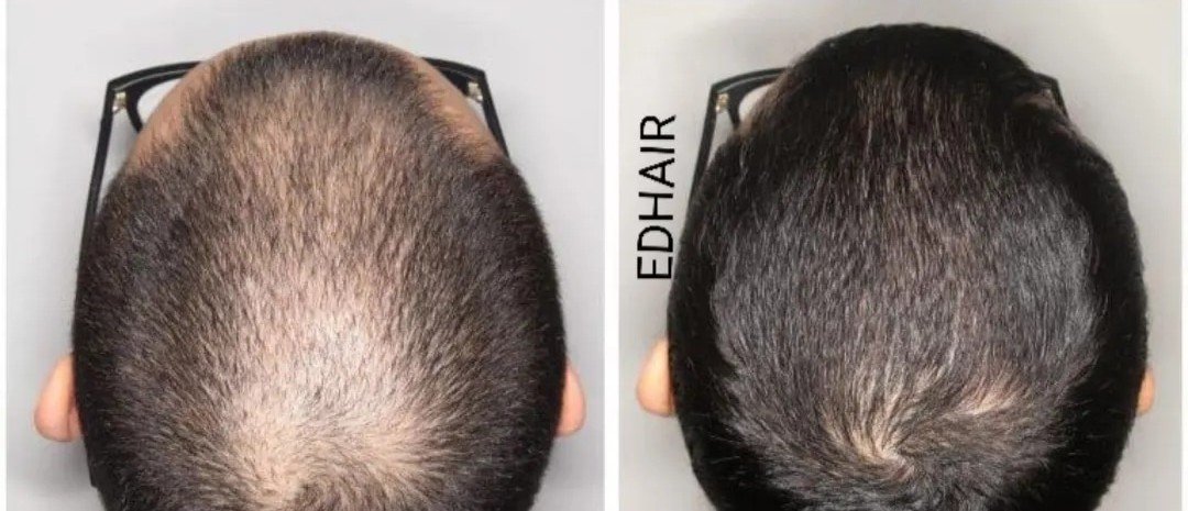 Kit de cuidado capilar - Image 3